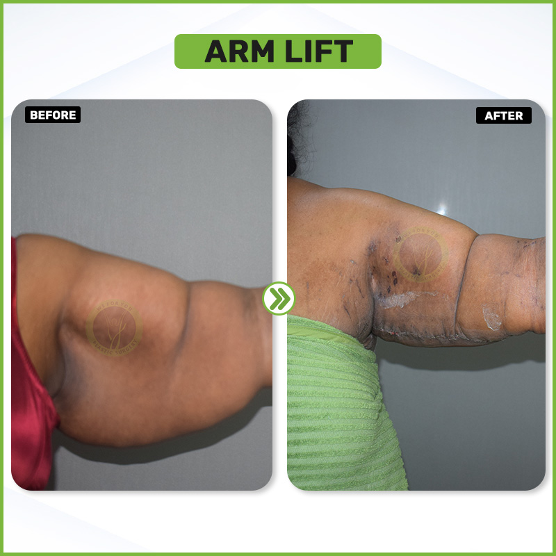 Before and After 13