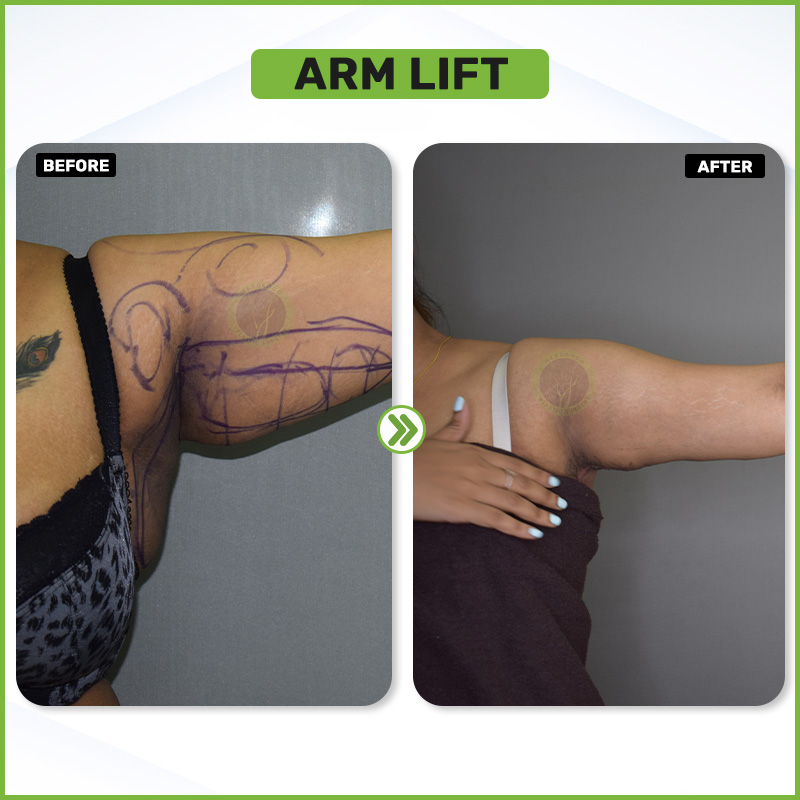Before and After 14
