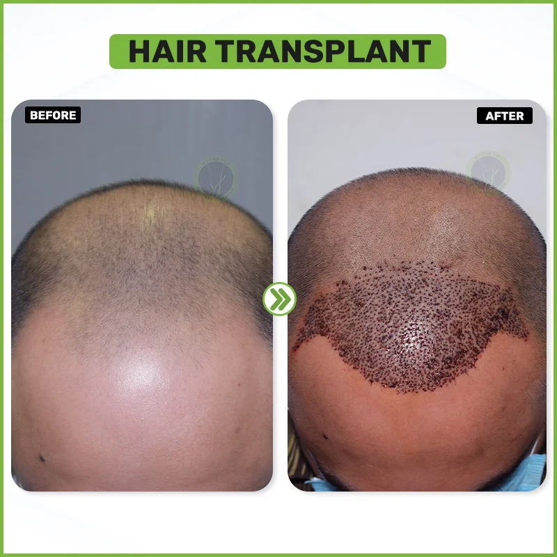 Before and After 8