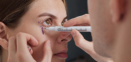 Blepharoplasty Eyelid Surgery