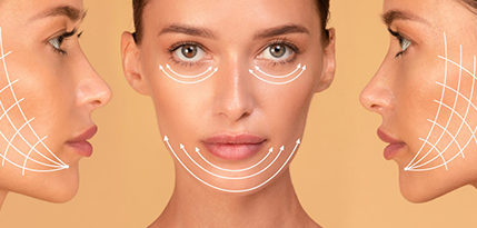 Facelift Surgery