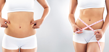 Liposuction Surgery