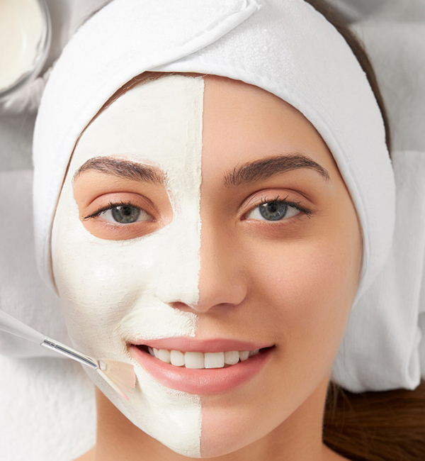 Chemical Peel treatment and consultation