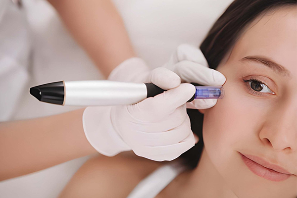 Microneedling Treatment in Gurgaon