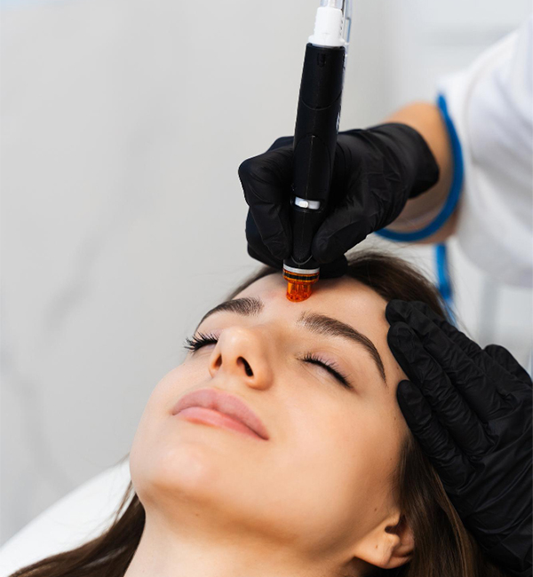 Microneedling treatment and consultation