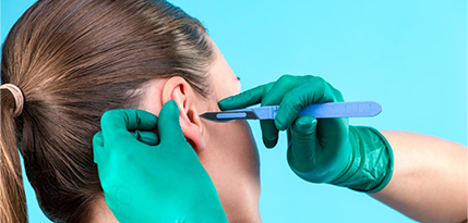 Otoplasty Ear Reshaping Surgery
