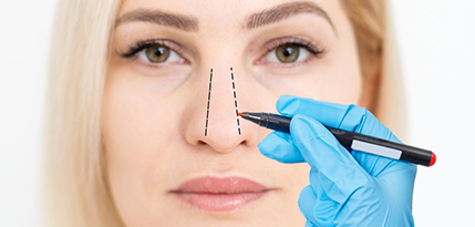 Rhinoplasty Surgery