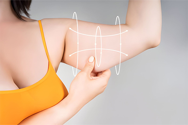 Arm Lift Surgery in Gurgaon