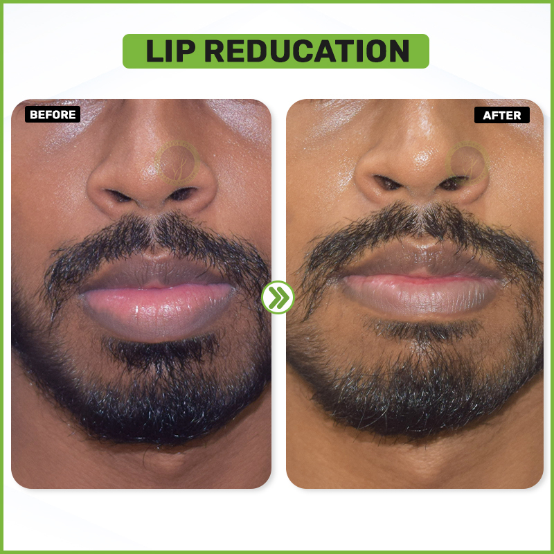 Before and After 7