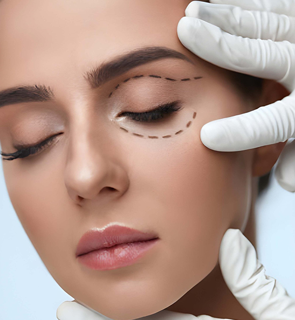 Blepharoplasty Eyelid Surgery treatment at WFY Plastic Surgery