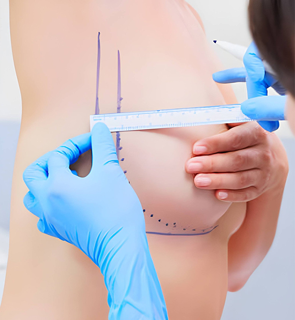Breast Augmentation Surgery treatment at WFY Plastic Surgery