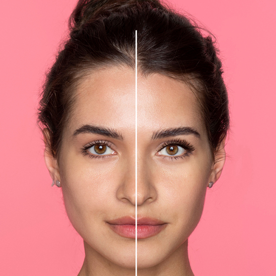 Brow Lift Surgery at WFY Plastic Surgery