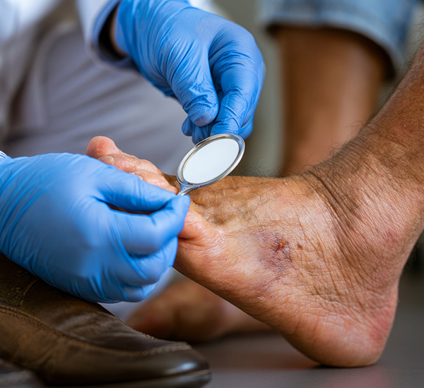 Diabetic foot surgery risks and treatment planning