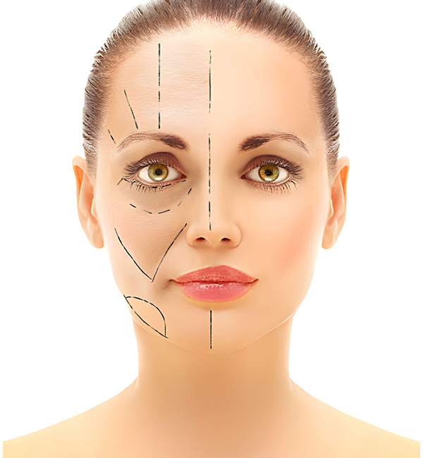 Facial fat grafting consultation and treatment planning