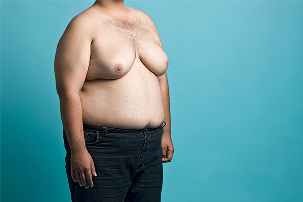 Gynecomastia Surgery in Gurgaon