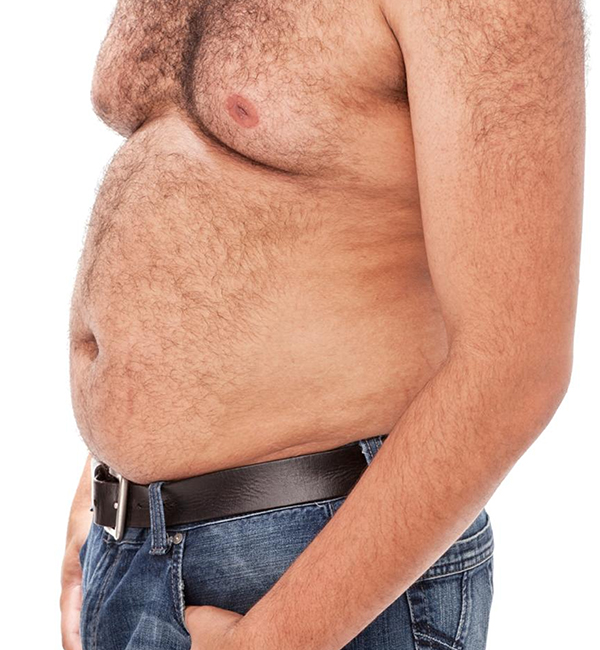 Gynecomastia surgery consultation and treatment planning