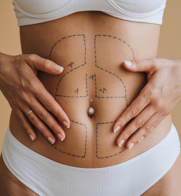 Liposuction surgery consultation and treatment planning