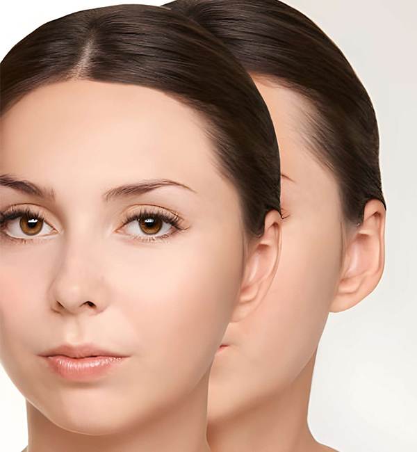 Otoplasty surgery consultation and treatment planning