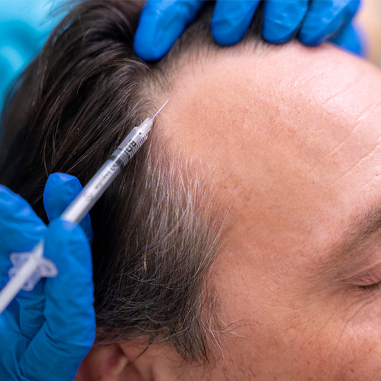 PRP Therapy Clinic in Gurgaon at WFY Plastic Surgery