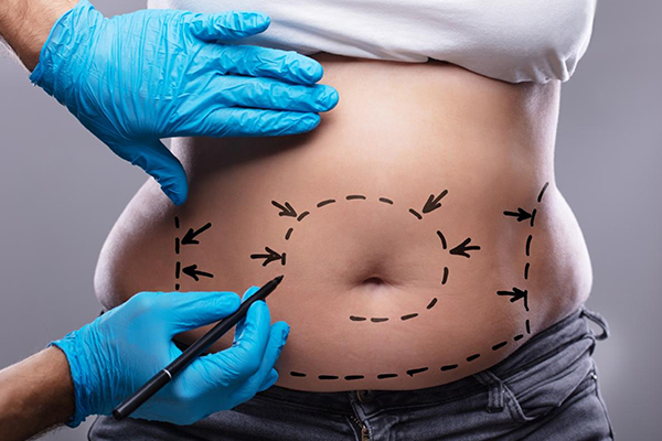Reconstructive Surgery in Gurgaon