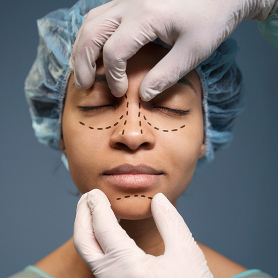 Rhinoplasty Surgery at WFY Plastic Surgery