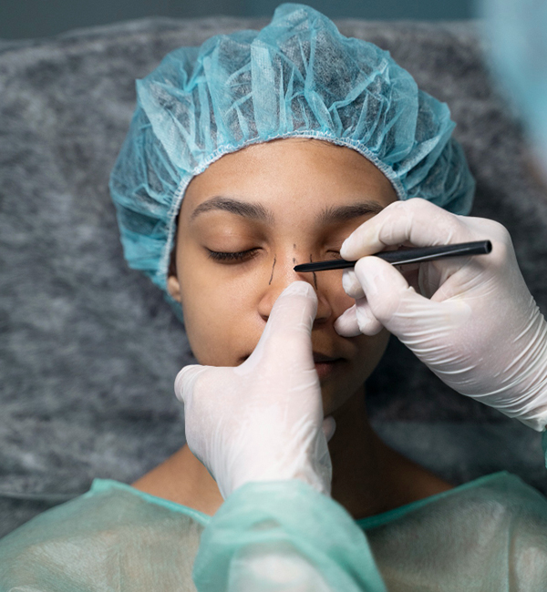 Rhinoplasty surgery consultation and treatment planning