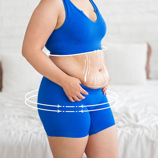 Tummy Tuck treatment at WFY Plastic Surgery