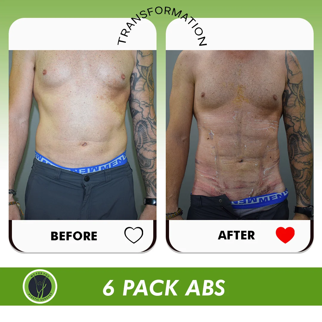 6 pack abs before and after