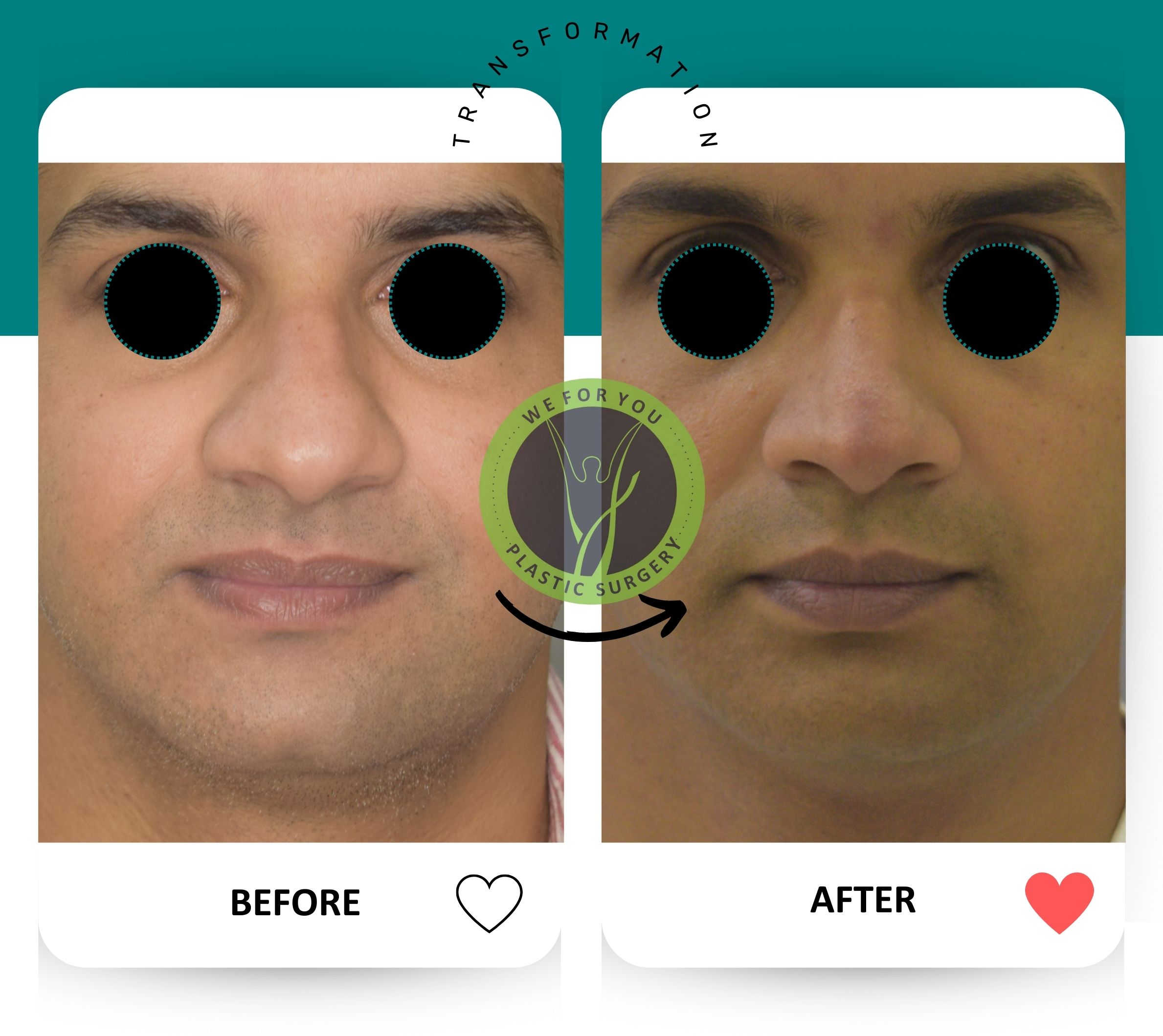 face surgery gallery